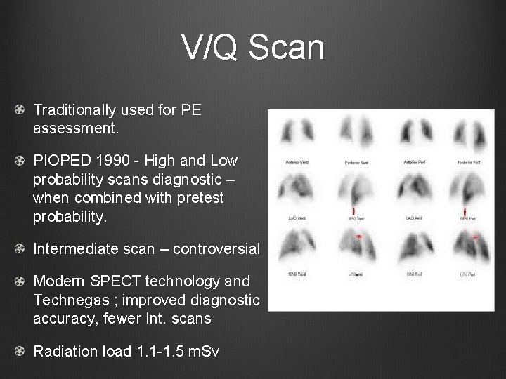 V/Q Scan Traditionally used for PE assessment. PIOPED 1990 - High and Low probability