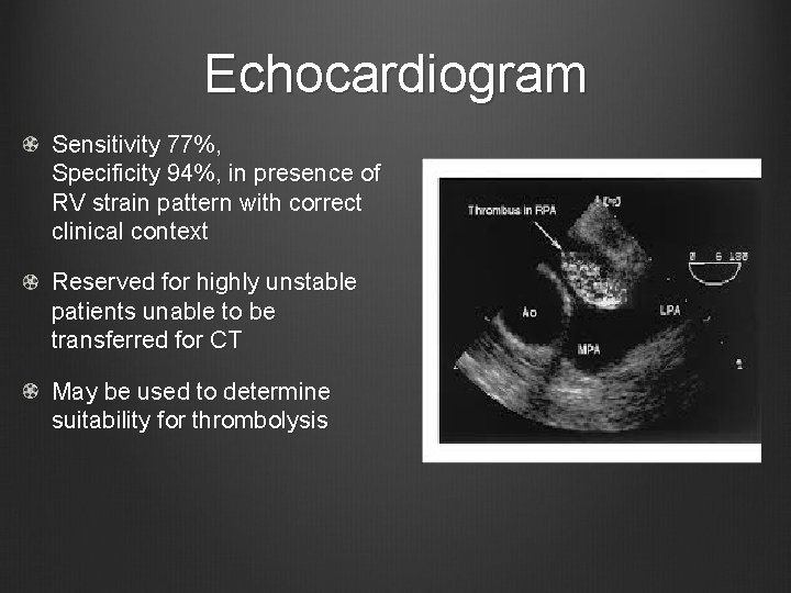 Echocardiogram Sensitivity 77%, Specificity 94%, in presence of RV strain pattern with correct clinical