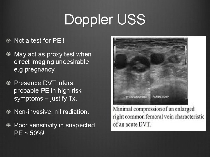 Doppler USS Not a test for PE ! May act as proxy test when