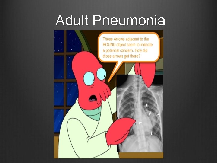 Adult Pneumonia 