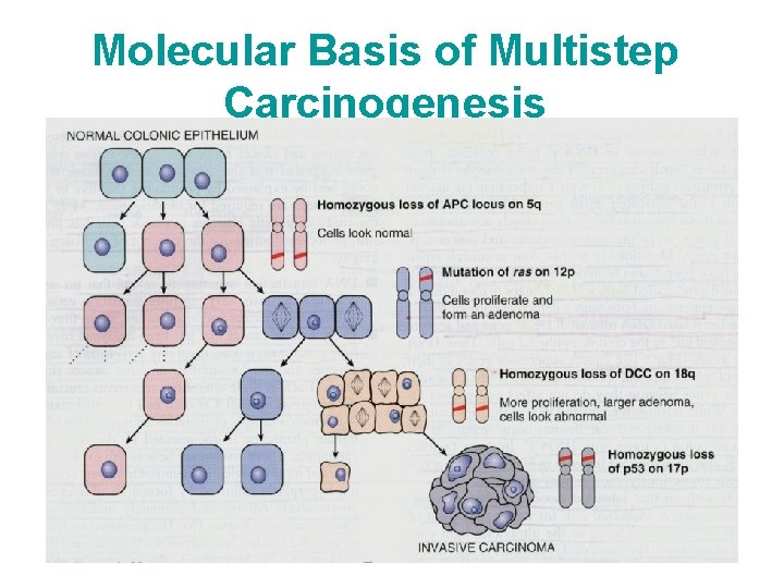 Molecular Basis of Multistep Carcinogenesis 