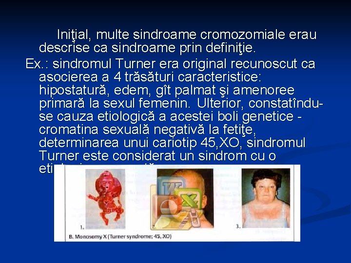 Iniţial, multe sindroame cromozomiale erau descrise ca sindroame prin definiţie. Ex. : sindromul Turner