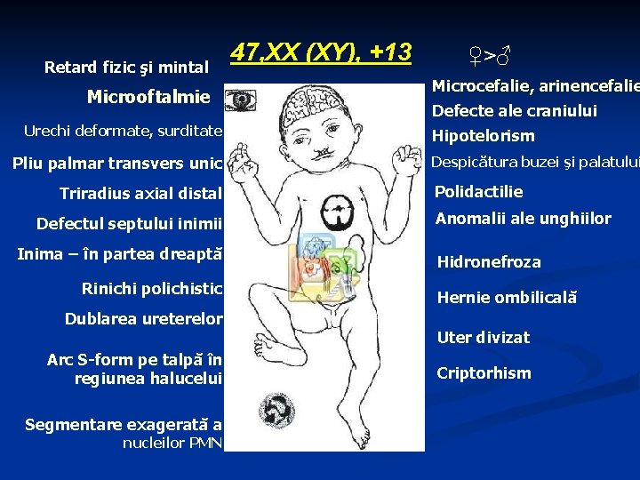 Retard fizic şi mintal Microoftalmie Urechi deformate, surditate Pliu palmar transvers unic Triradius axial