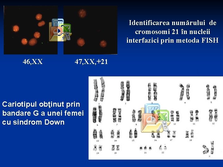 Identificarea numărului de cromosomi 21 în nucleii interfazici prin metoda FISH 46, XX 47,