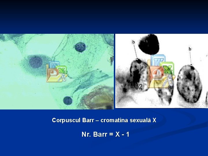 Corpuscul Barr – cromatina sexuală X Nr. Barr = X - 1 