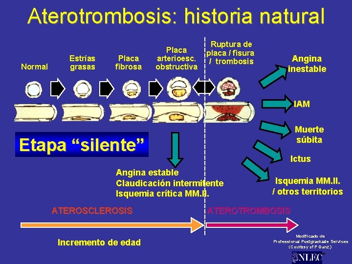 Aterotrombosis: historia natural Normal Estrías grasas Placa fibrosa Placa arterioesc. obstructiva Ruptura de placa
