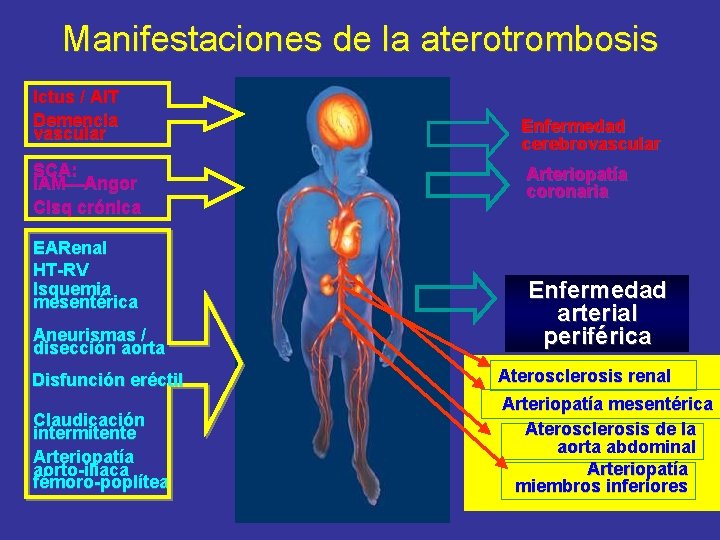 Manifestaciones de la aterotrombosis Ictus / AIT Demencia vascular SCA: IAM Angor CIsq crónica