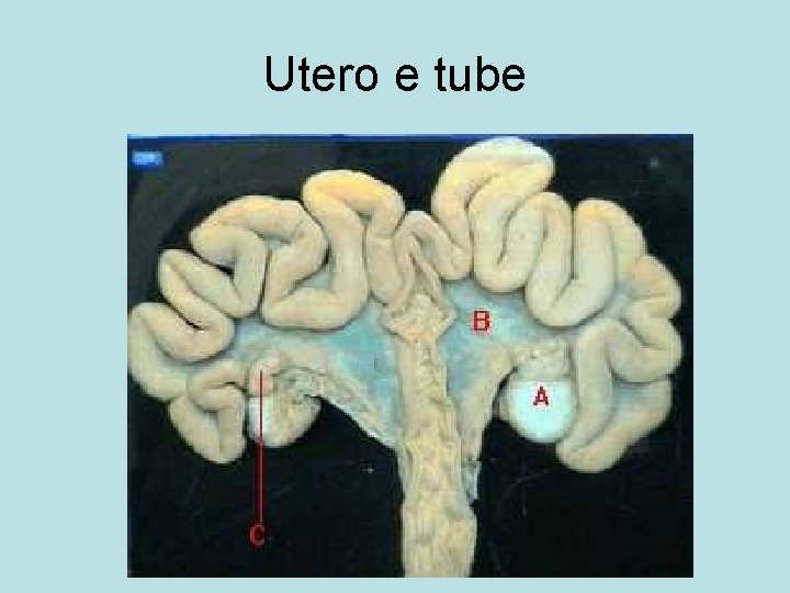 Utero e tube 