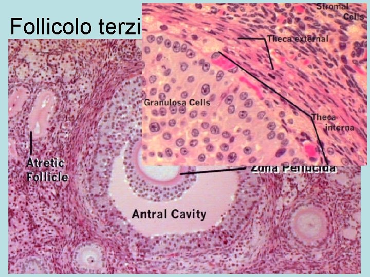 Follicolo terziario 