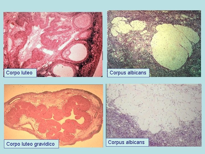 Corpo luteo gravidico Corpus albicans 