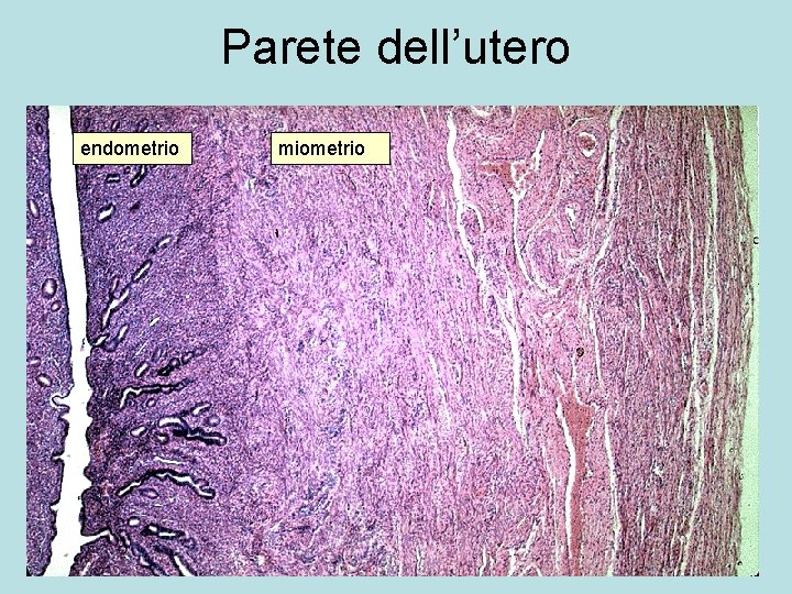 Parete dell’utero endometrio miometrio 