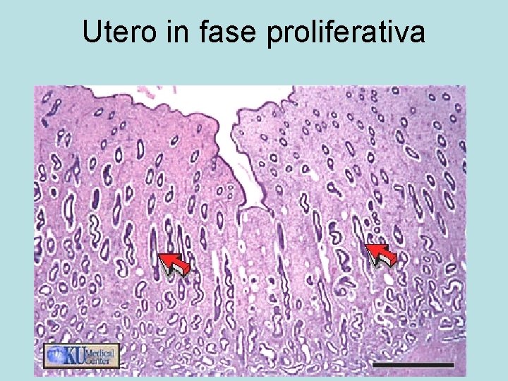 Utero in fase proliferativa 