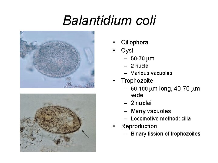 Balantidium coli • Ciliophora • Cyst – 50 -70 m – 2 nuclei –