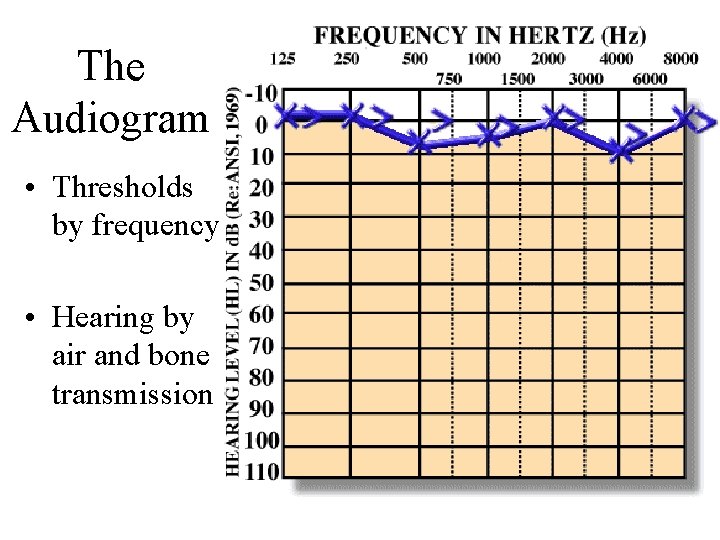 The Audiogram • Thresholds by frequency • Hearing by air and bone transmission 