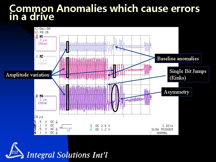 Common Anomalies which cause errors in a drive Baseline anomalies Amplitude variation Single Bit