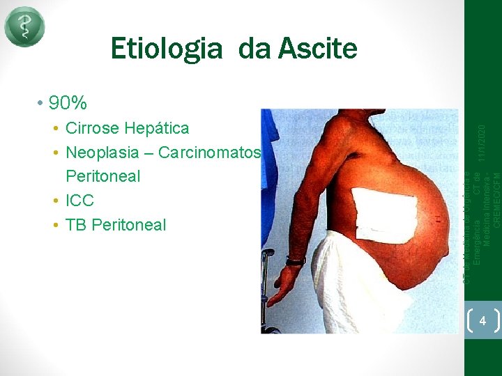 Etiologia da Ascite CT de Medicina de Urgência e Emergência CT de Medicina Intensiva