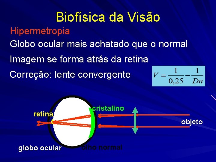 Biofísica da Visão Hipermetropia Globo ocular mais achatado que o normal Imagem se forma