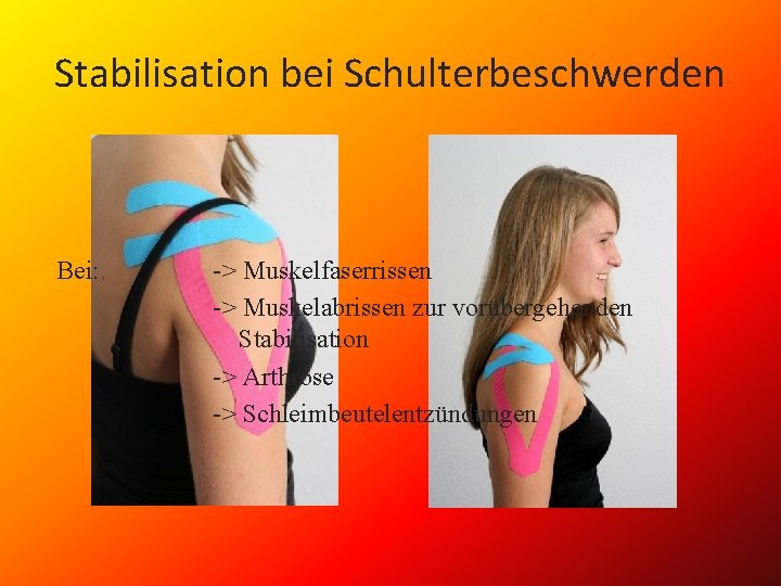Stabilisation bei Schulterbeschwerden Bei: -> Muskelfaserrissen -> Muskelabrissen zur vorübergehenden Stabilisation -> Arthrose ->