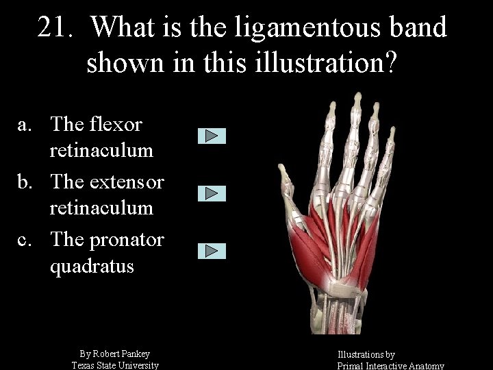 21. What is the ligamentous band shown in this illustration? a. The flexor retinaculum