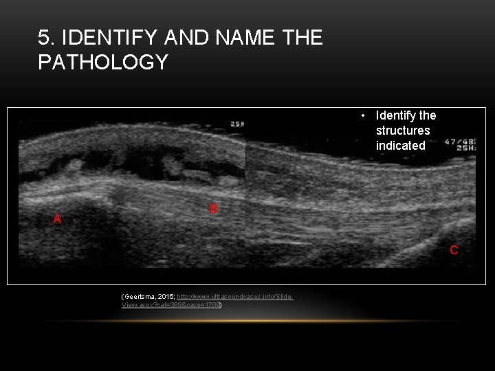 5. IDENTIFY AND NAME THE PATHOLOGY • Identify the structures indicated A B C