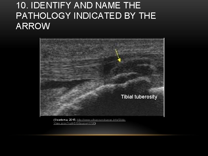 10. IDENTIFY AND NAME THE PATHOLOGY INDICATED BY THE ARROW Tibial tuberosity (Geertsma, 2015;