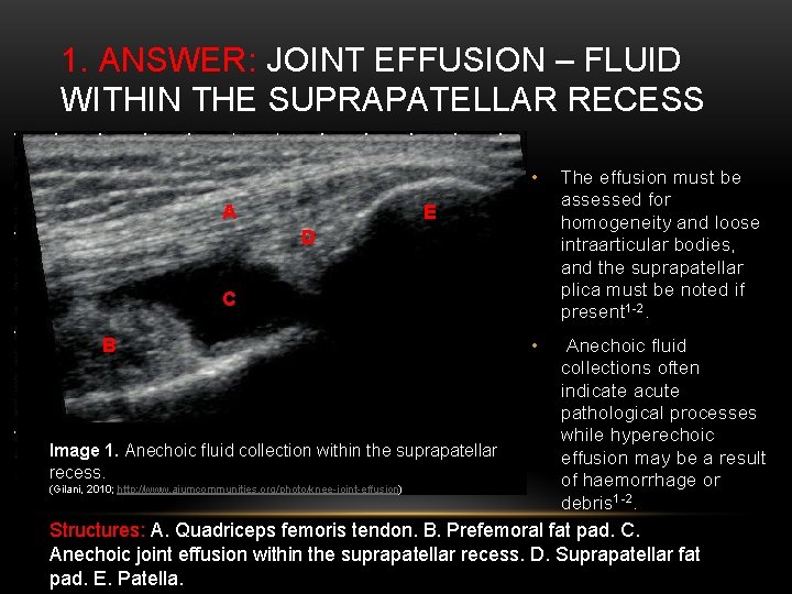 1. ANSWER: JOINT EFFUSION – FLUID WITHIN THE SUPRAPATELLAR RECESS A A B D