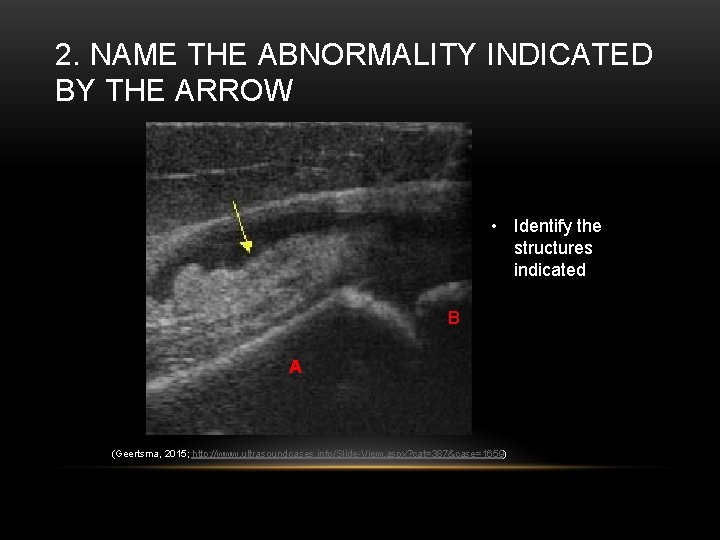 2. NAME THE ABNORMALITY INDICATED BY THE ARROW • Identify the structures indicated B