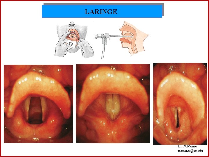 LARINGE Dr M Monzo mmonzo@ub. edu 