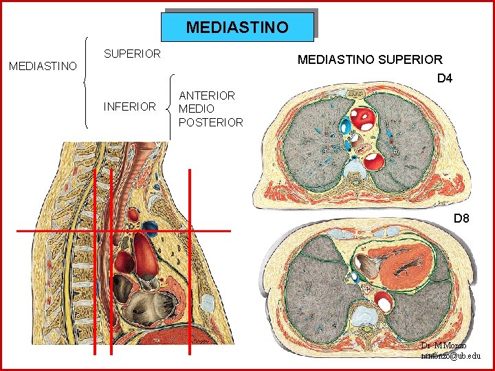 MEDIASTINO SUPERIOR D 4 MEDIASTINO INFERIOR ANTERIOR MEDIO POSTERIOR D 8 Dr M Monzo