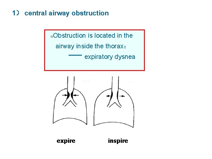1） central airway obstruction ■Obstruction is located in the airway inside thorax： expiratory dysnea