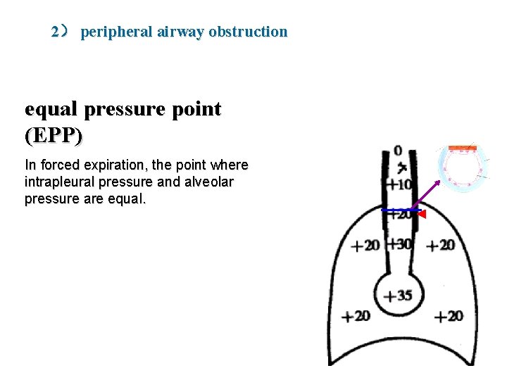2） peripheral airway obstruction equal pressure point (EPP) In forced expiration, the point where