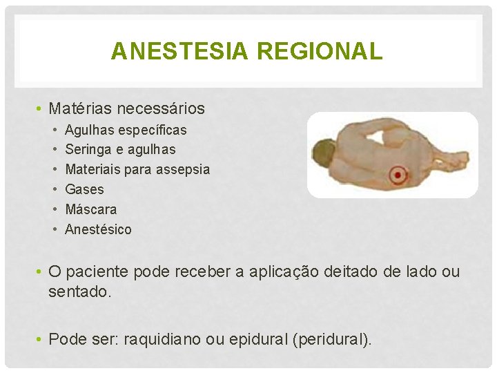 ANESTESIA REGIONAL • Matérias necessários • • • Agulhas específicas Seringa e agulhas Materiais