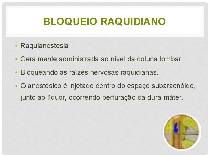 BLOQUEIO RAQUIDIANO • Raquianestesia • Geralmente administrada ao nível da coluna lombar. • Bloqueando