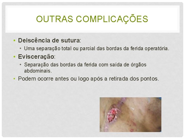 OUTRAS COMPLICAÇÕES • Deiscência de sutura: • Uma separação total ou parcial das bordas