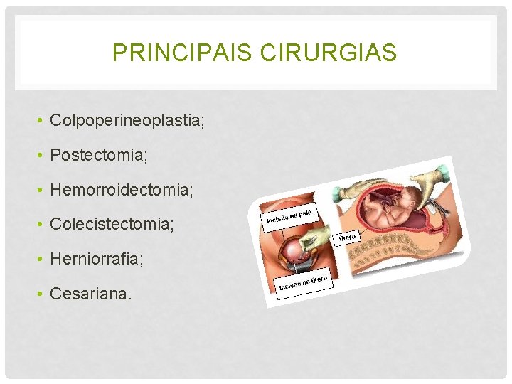 PRINCIPAIS CIRURGIAS • Colpoperineoplastia; • Postectomia; • Hemorroidectomia; • Colecistectomia; • Herniorrafia; • Cesariana.