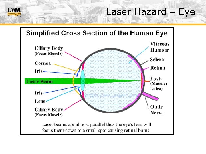 Laser Hazard – Eye 