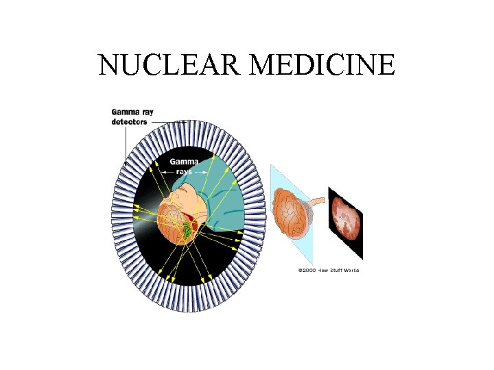 NUCLEAR MEDICINE 