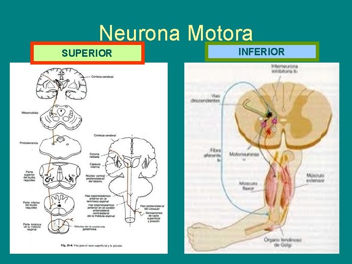 Neurona Motora SUPERIOR INFERIOR 