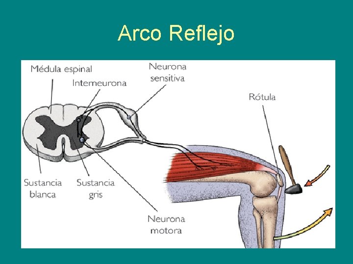 Arco Reflejo 