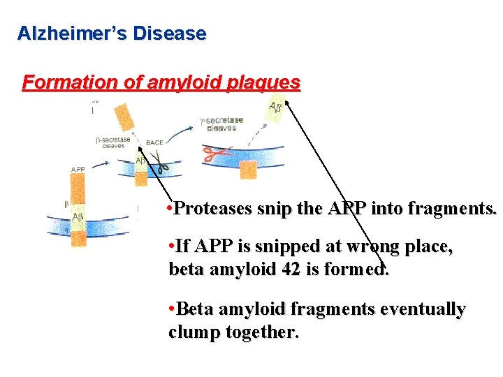 Alzheimer’s Disease Formation of amyloid plaques • Proteases snip the APP into fragments. • Alzheimer’s Disease Formation of amyloid plaques • Proteases snip the APP into fragments. •