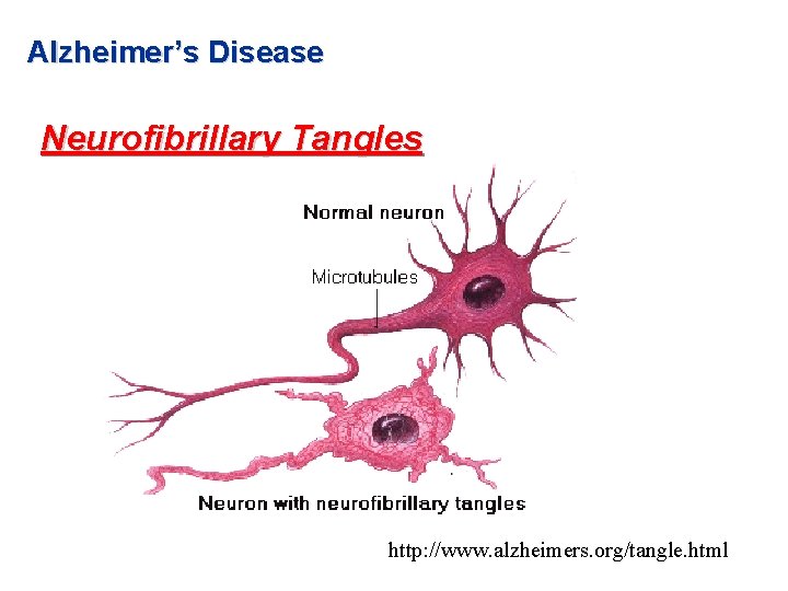 Alzheimer’s Disease Neurofibrillary Tangles http: //www. alzheimers. org/tangle. html Alzheimer’s Disease Neurofibrillary Tangles http: //www. alzheimers. org/tangle. html