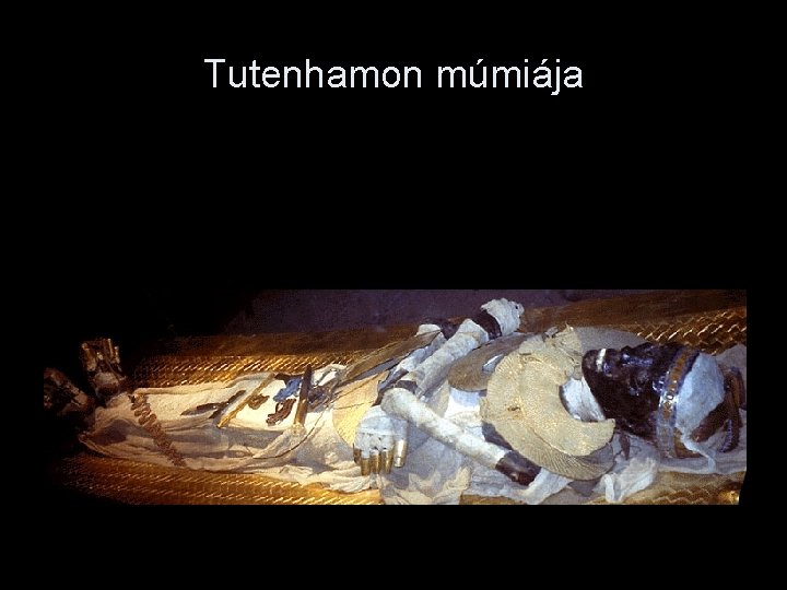 Tutenhamon múmiája 