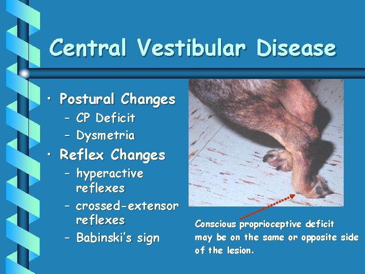 Central Vestibular Disease • Postural Changes – CP Deficit – Dysmetria • Reflex Changes