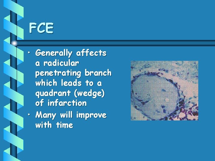 FCE • Generally affects a radicular penetrating branch which leads to a quadrant (wedge)