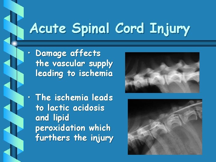 Acute Spinal Cord Injury • Damage affects the vascular supply leading to ischemia •