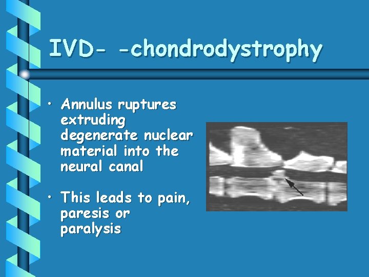 IVD- -chondrodystrophy • Annulus ruptures extruding degenerate nuclear material into the neural canal •