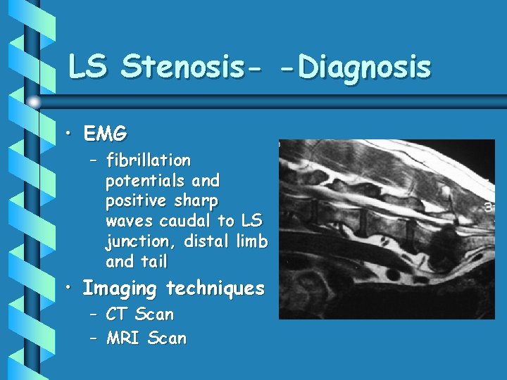 LS Stenosis- -Diagnosis • EMG – fibrillation potentials and positive sharp waves caudal to