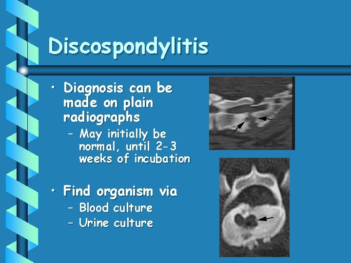 Discospondylitis • Diagnosis can be made on plain radiographs – May initially be normal,