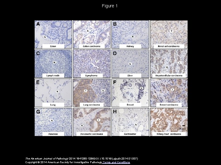 Figure 1 The American Journal of Pathology 2014 1841280 -1286 DOI: (10. 1016/j. ajpath.