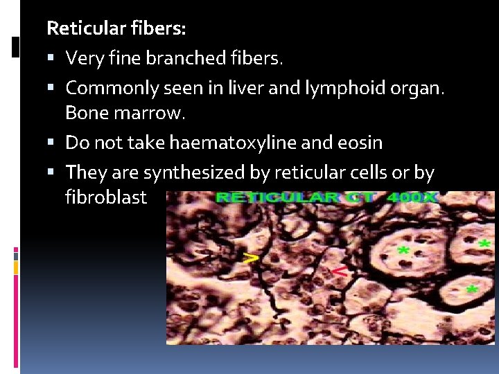 Reticular fibers: Very fine branched fibers. Commonly seen in liver and lymphoid organ. Bone